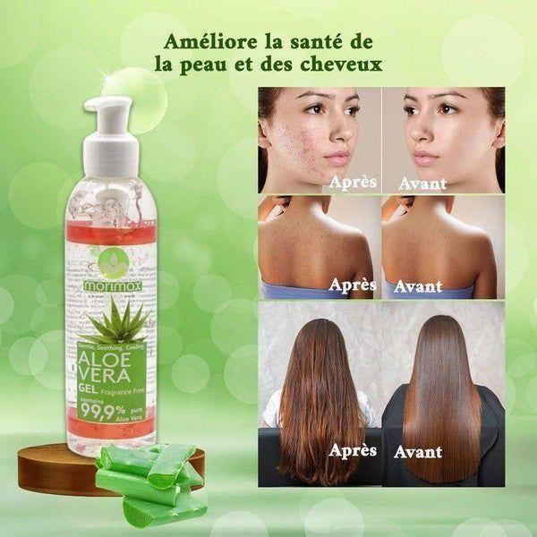 Morimax Aloe Vera Gel 200ml - Image 4
